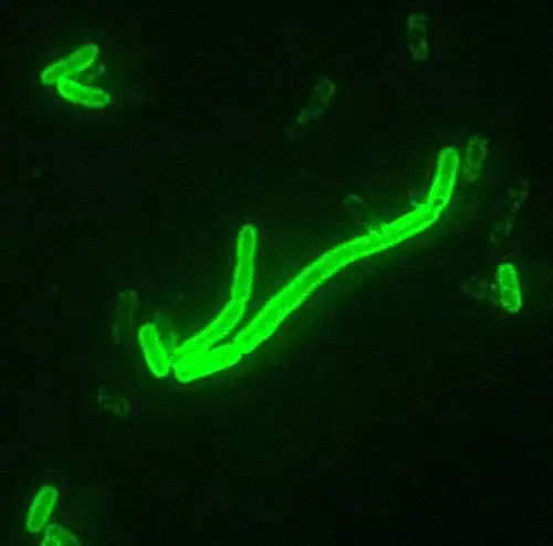 Yersinia pestis (200 × magnification), the bacterium that causes plague