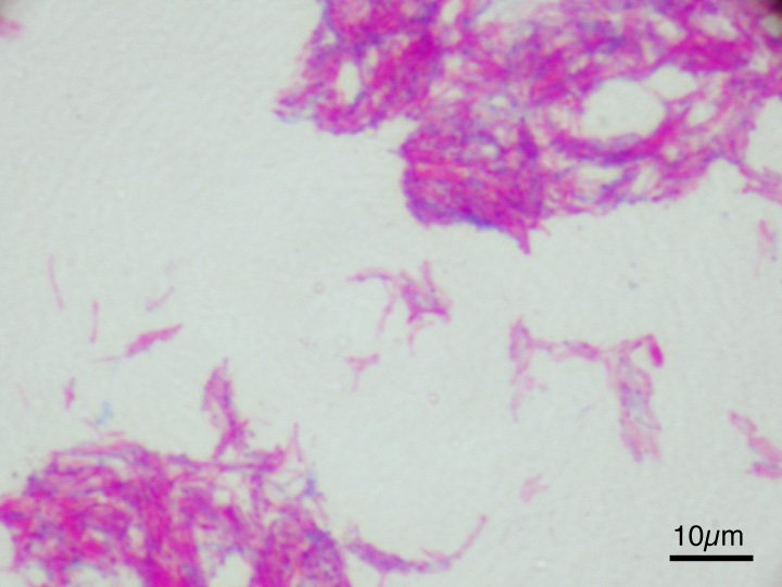Microscopic image of the Calmette–Guérin bacillus, Ziehl–Neelsen stain, magnification: 1,000nn